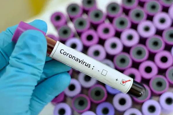 Coronavirus test results